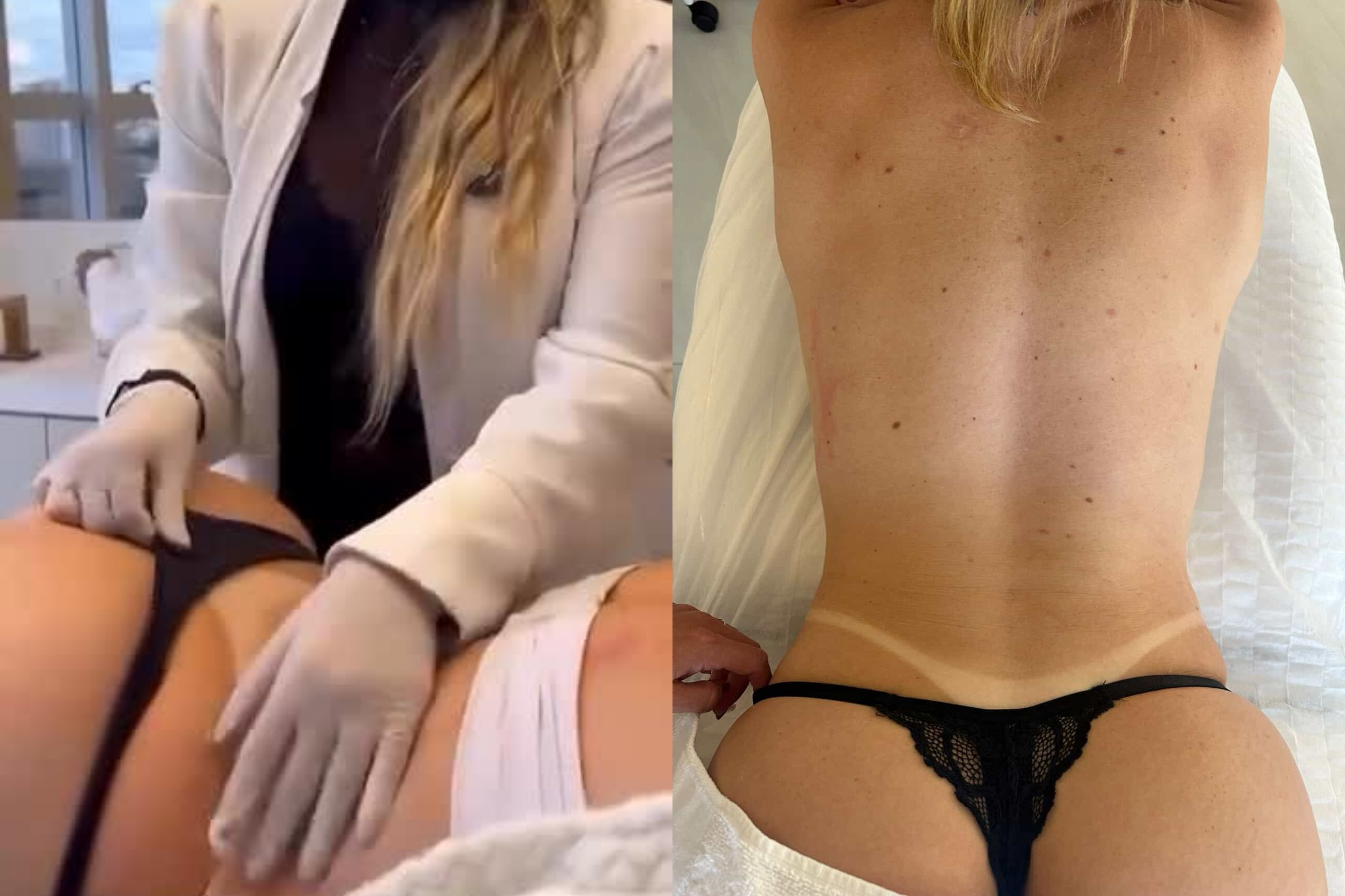 Antes e depois · Corporal · Vivency