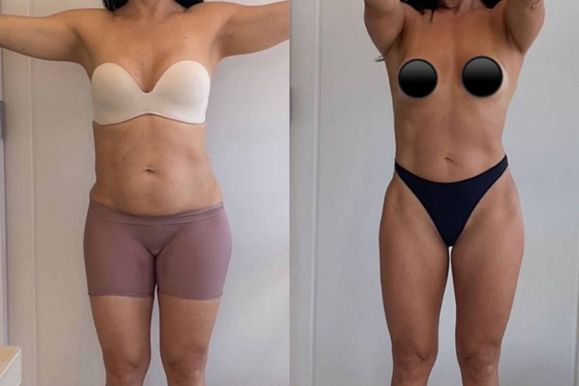 Antes e depois · Emagrecimento · Vivency