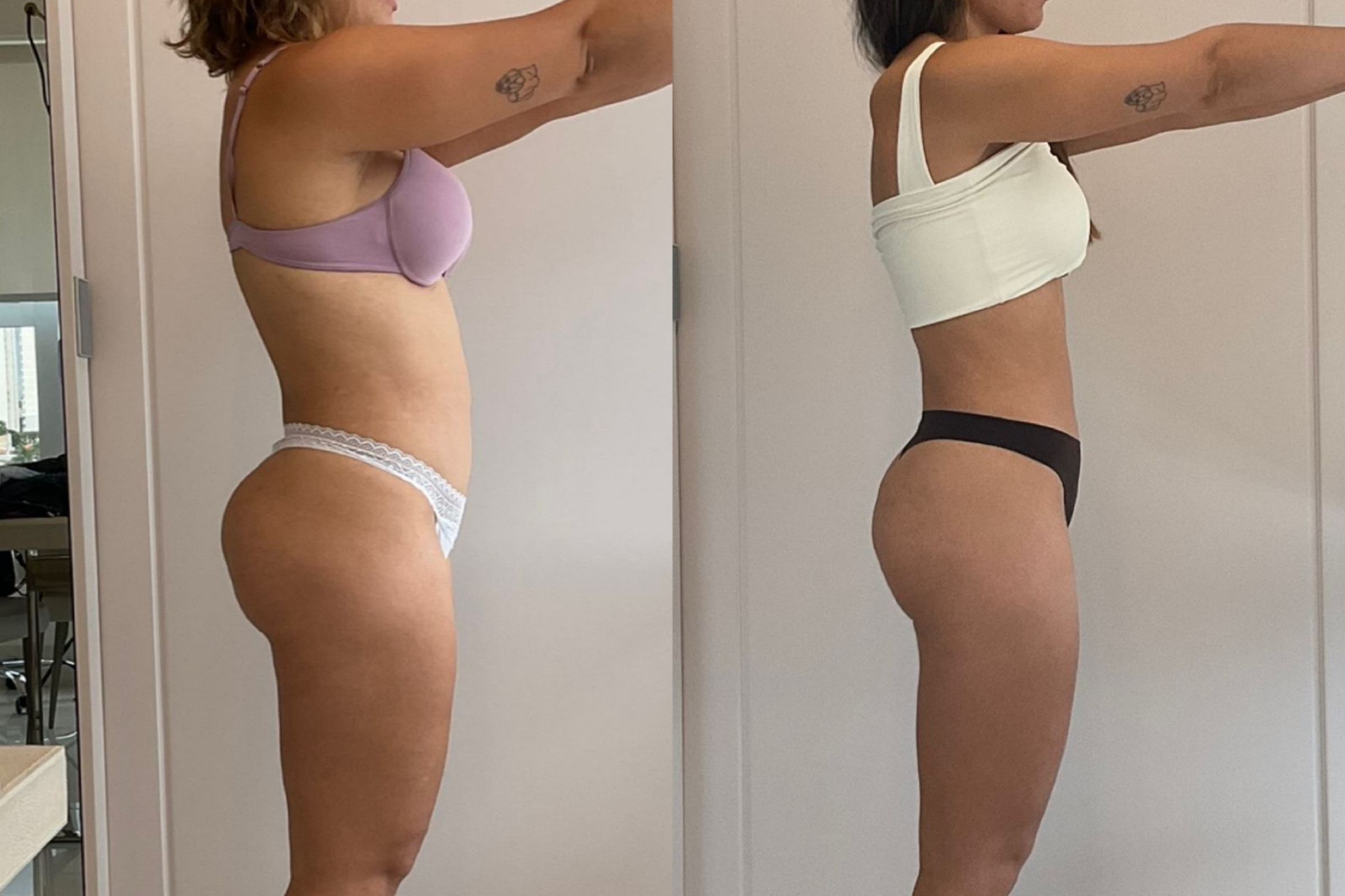 Antes e depois · Emagrecimento · Vivency
