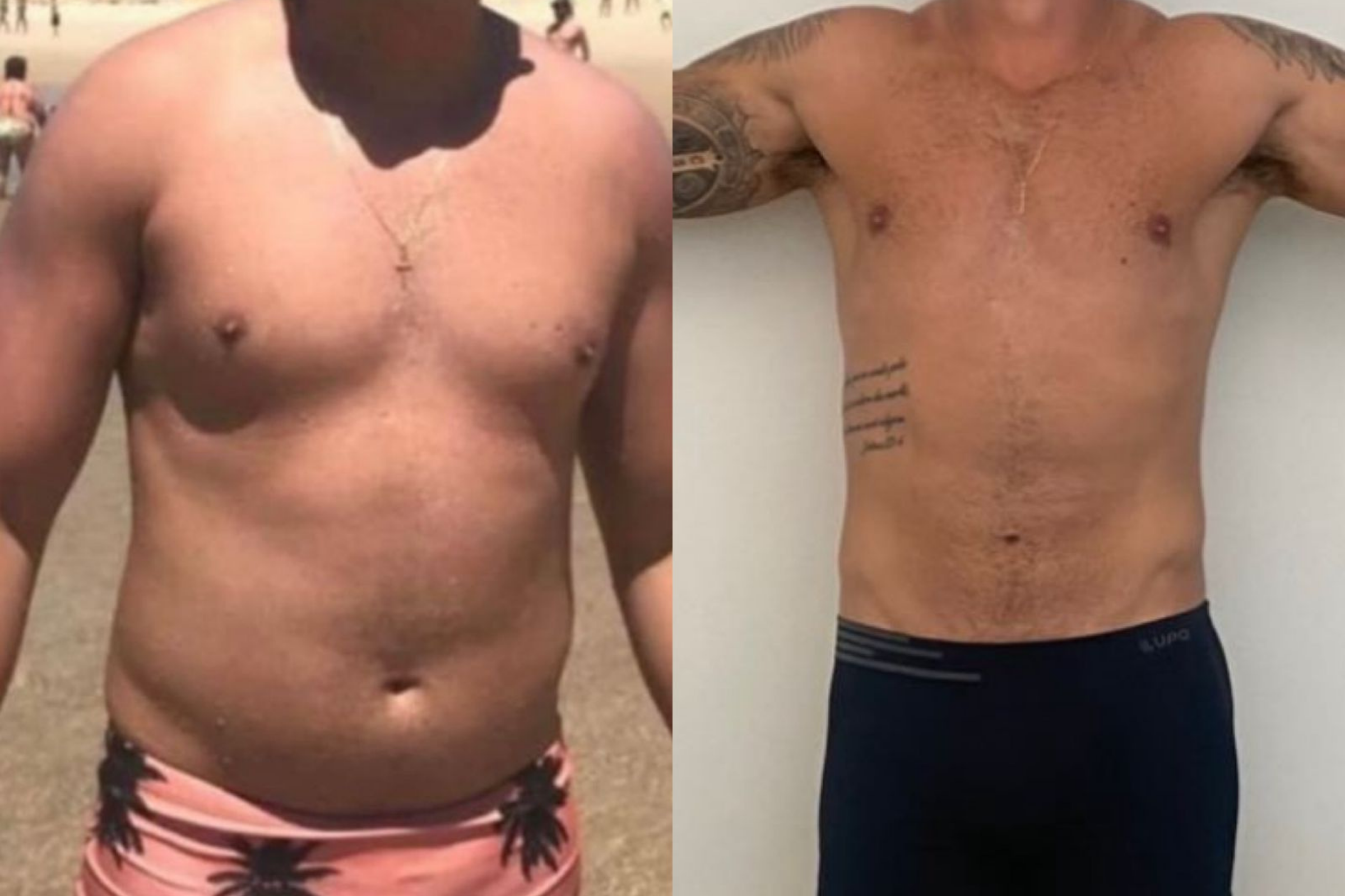 Antes e depois · Emagrecimento · Vivency
