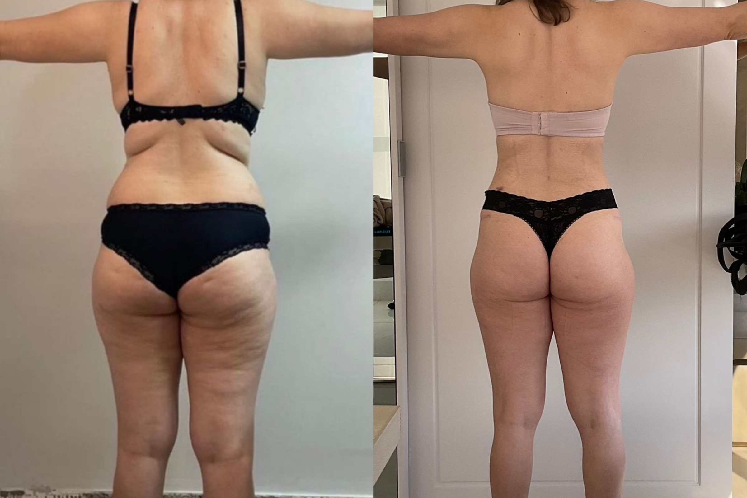 Antes e depois · Emagrecimento · Vivency