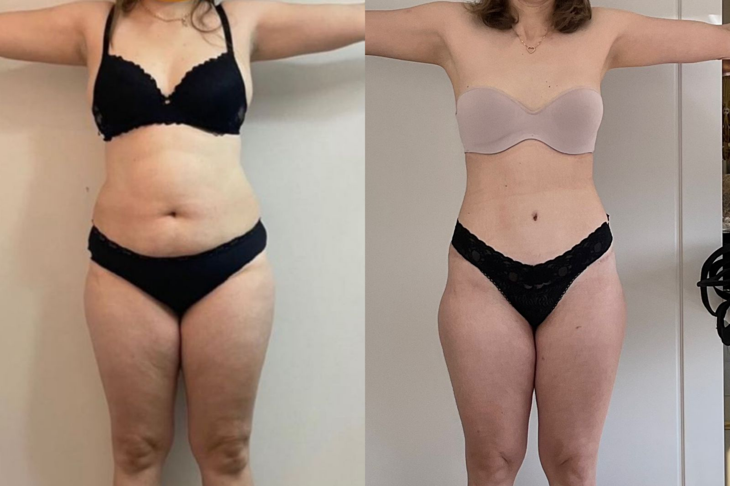 Antes e depois · Emagrecimento · Vivency