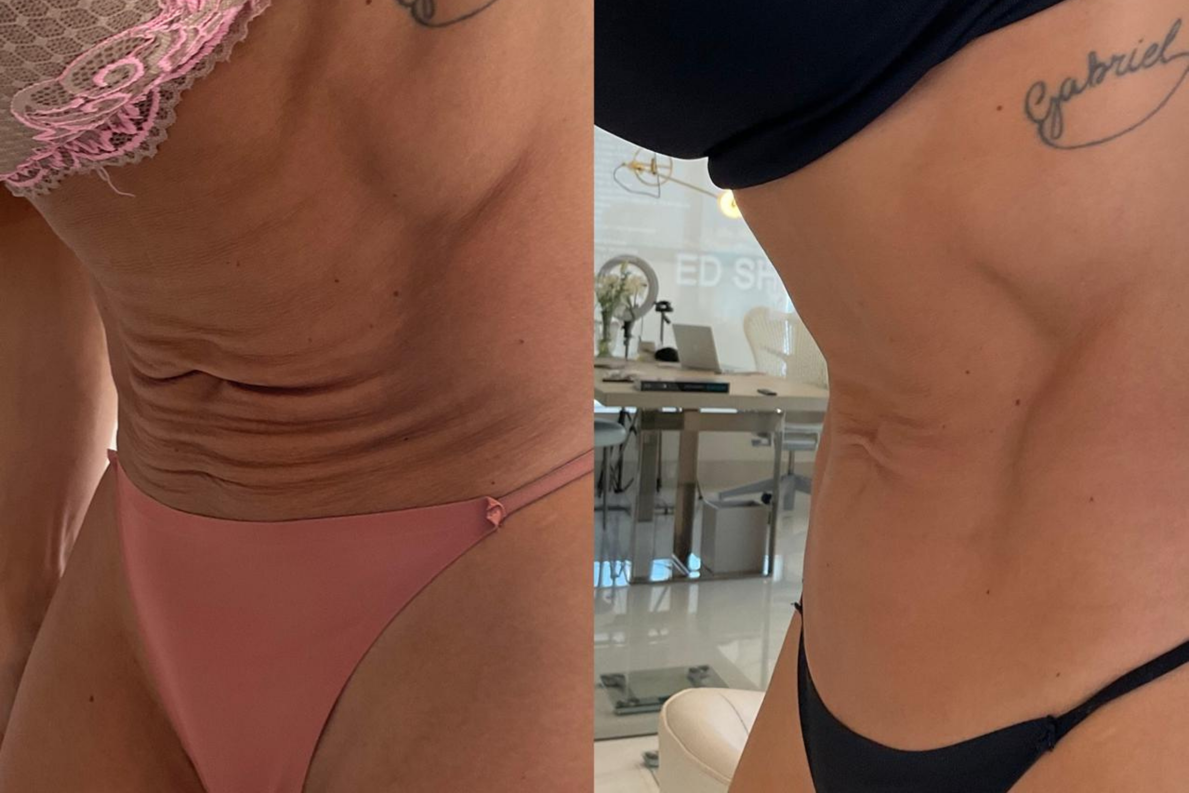 Antes e depois · Corporal · Vivency