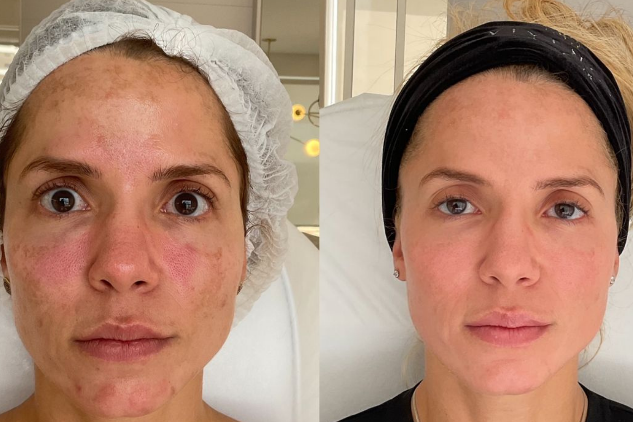 Antes e depois · Facial · Vivency