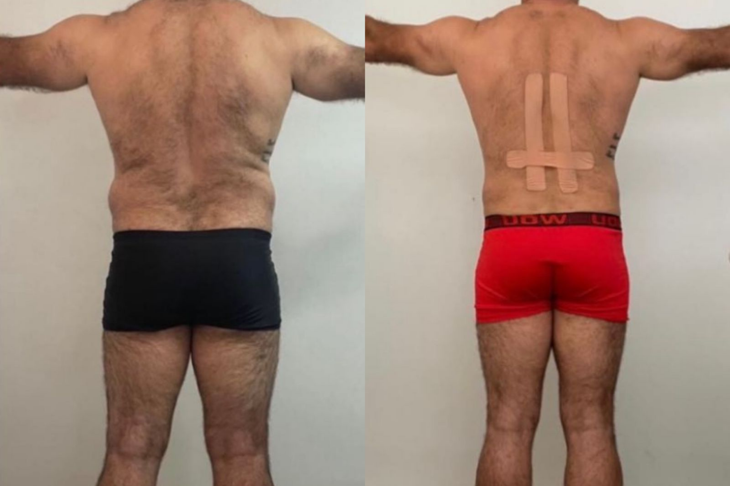 Antes e depois · Emagrecimento · Vivency