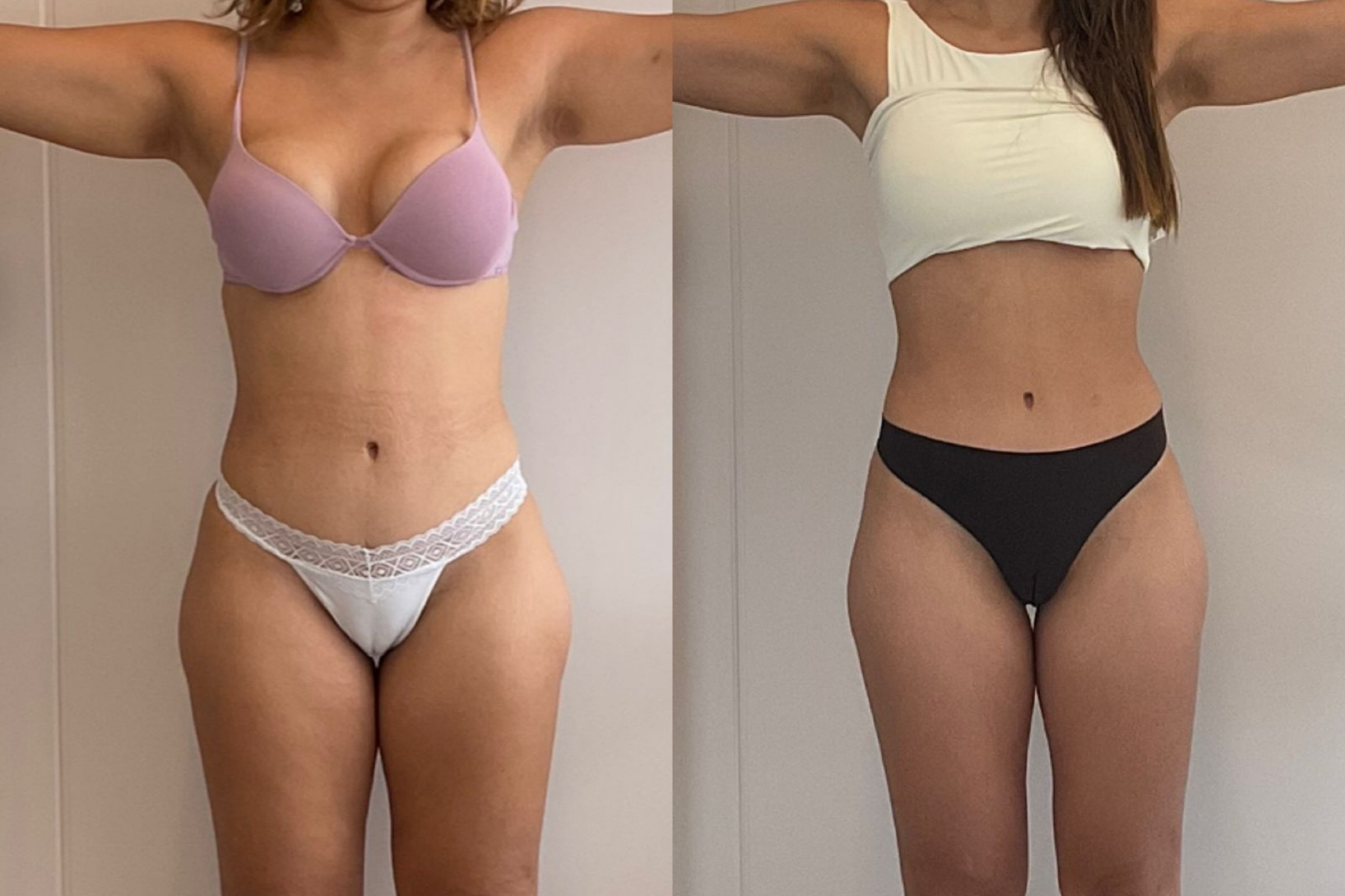 Antes e depois · Emagrecimento · Vivency