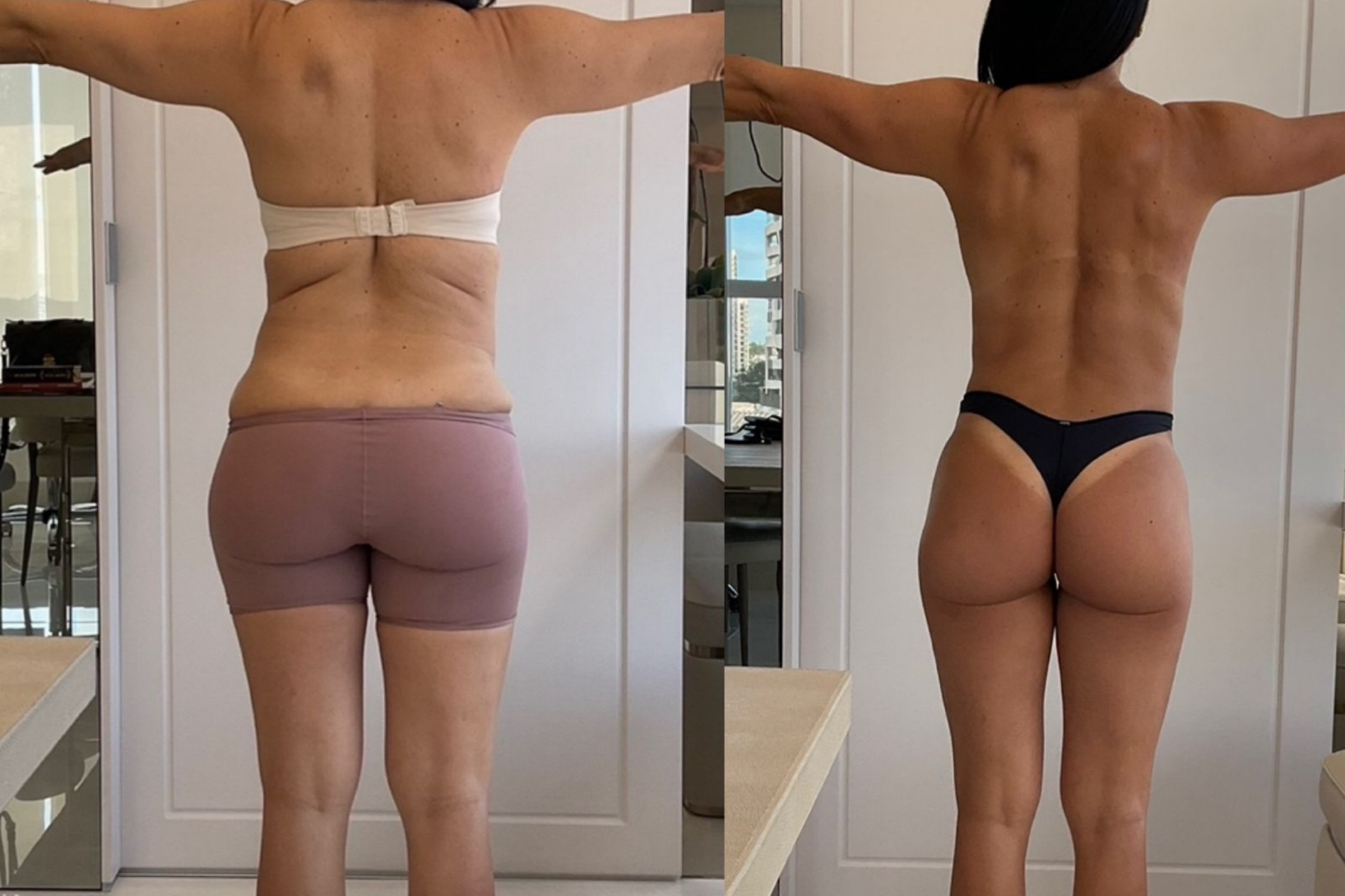 Antes e depois · Emagrecimento · Vivency
