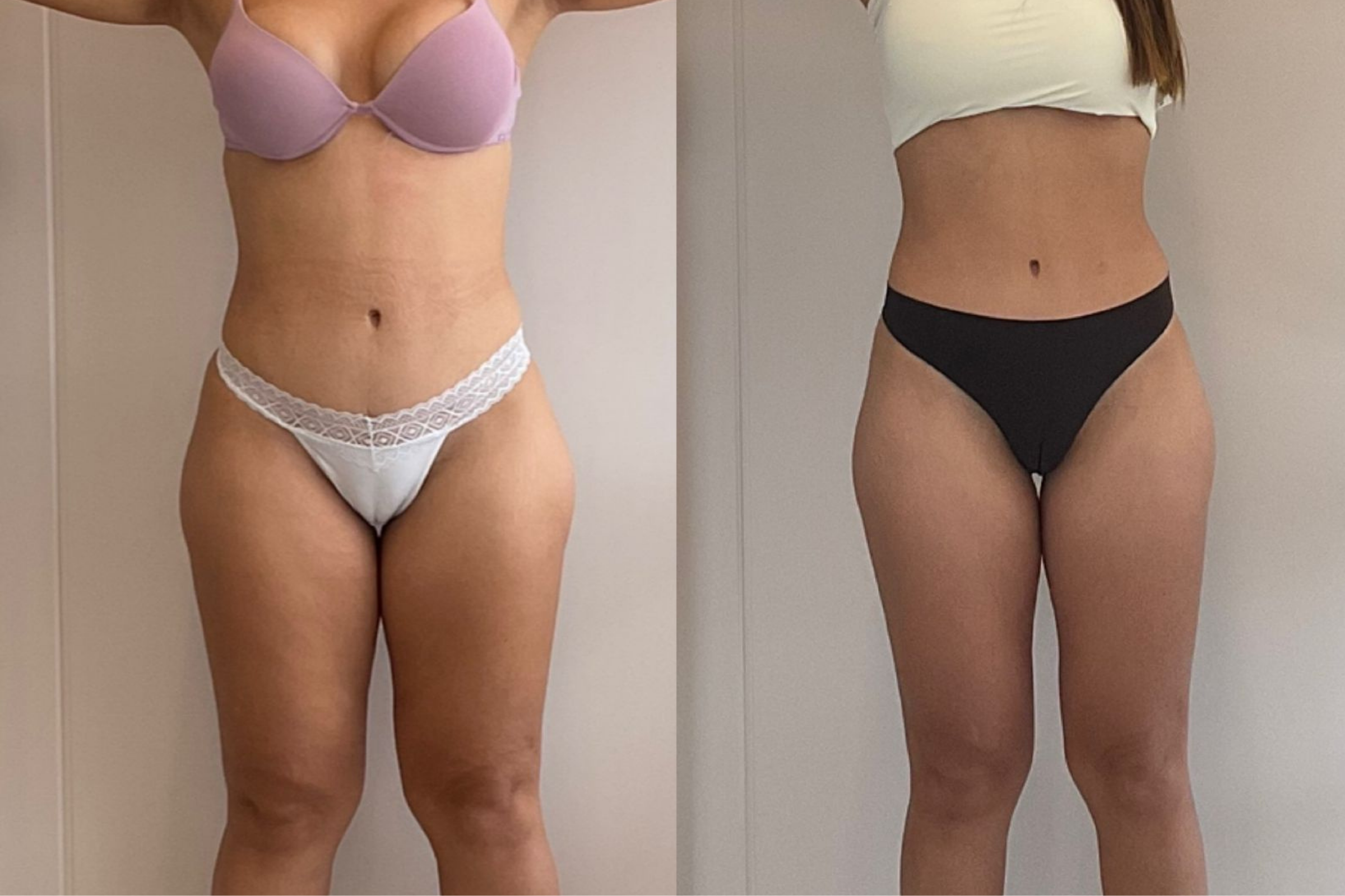 Antes e depois · Emagrecimento · Vivency