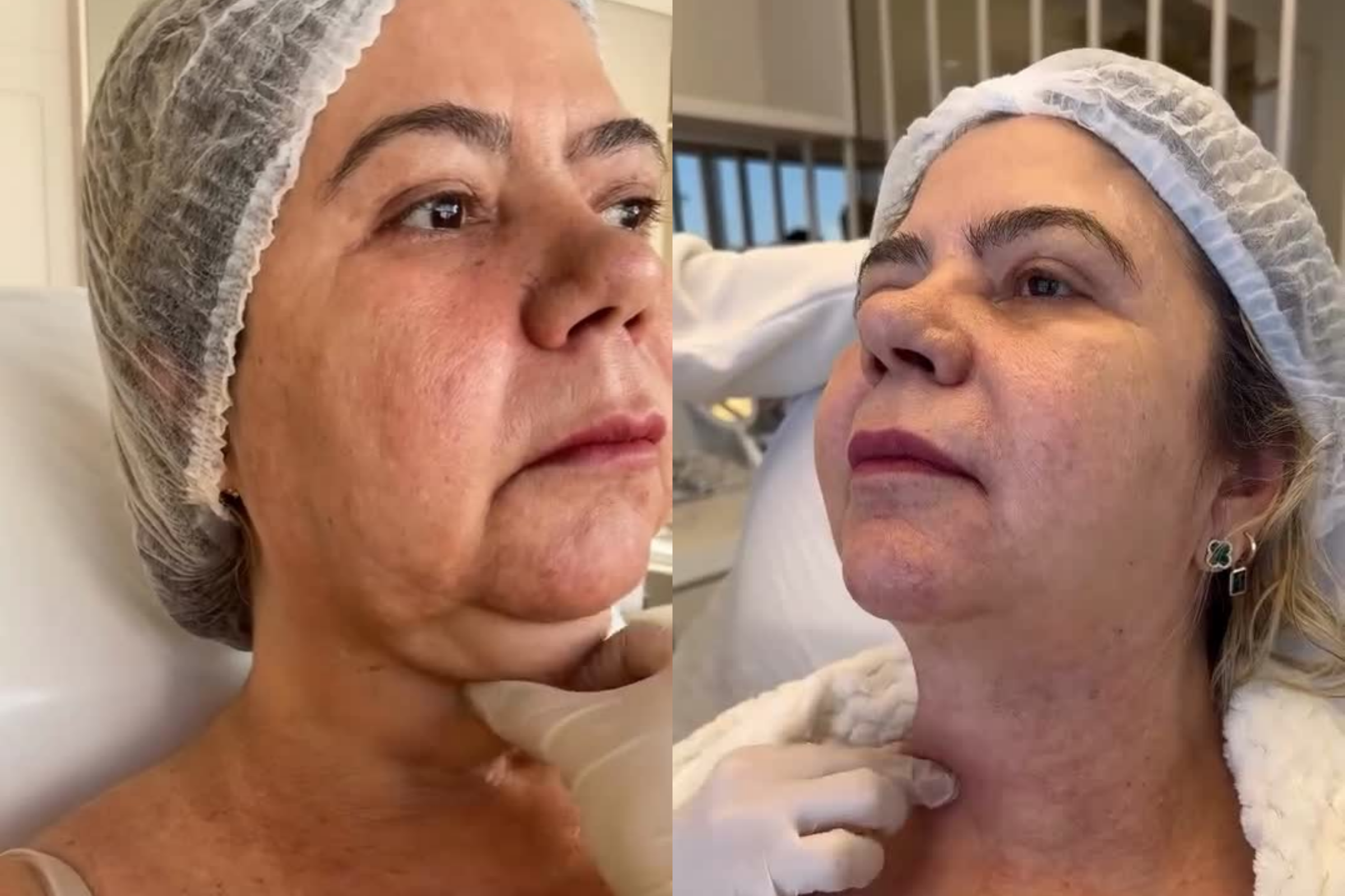 Antes e depois · Facial · Vivency
