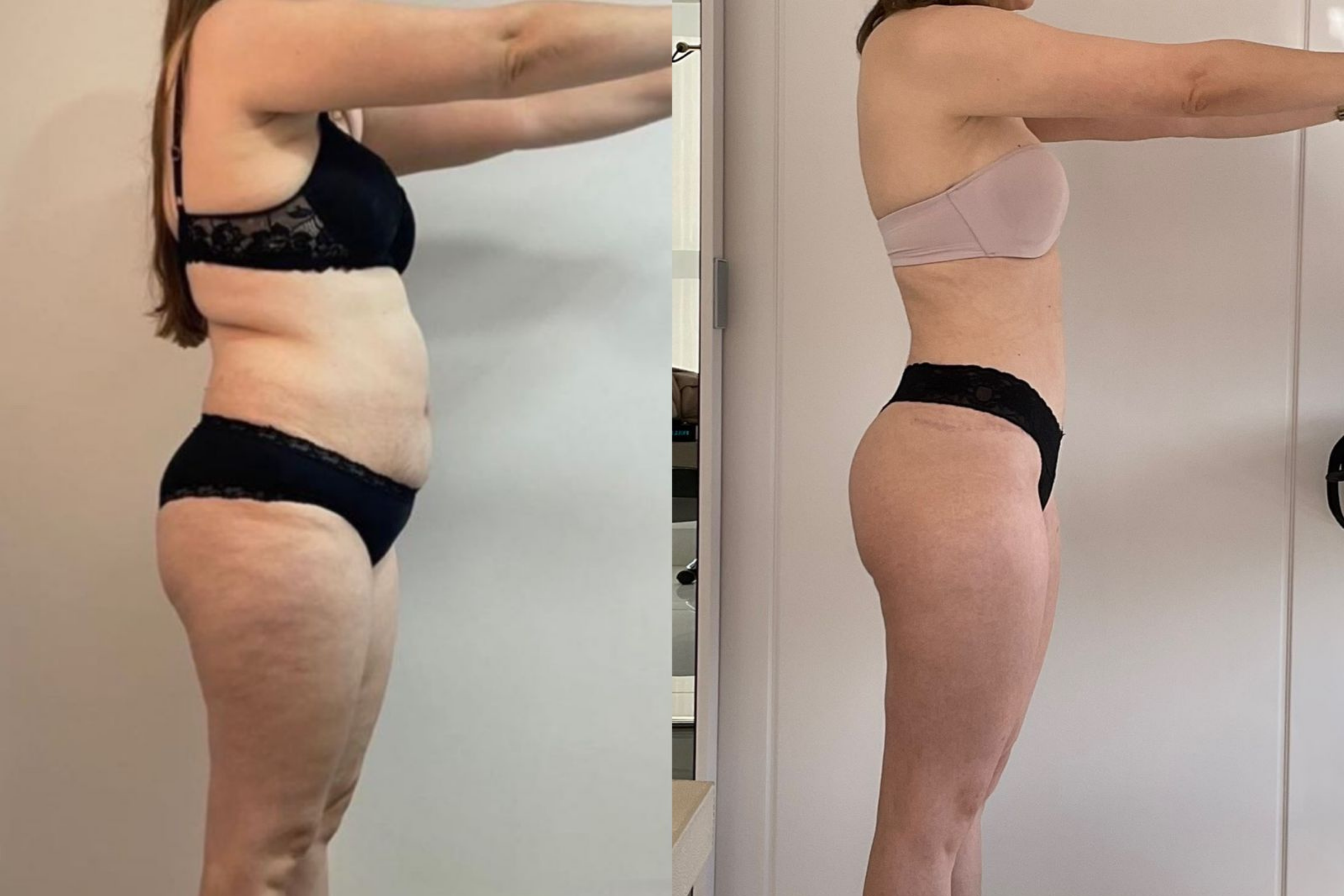 Antes e depois · Emagrecimento · Vivency