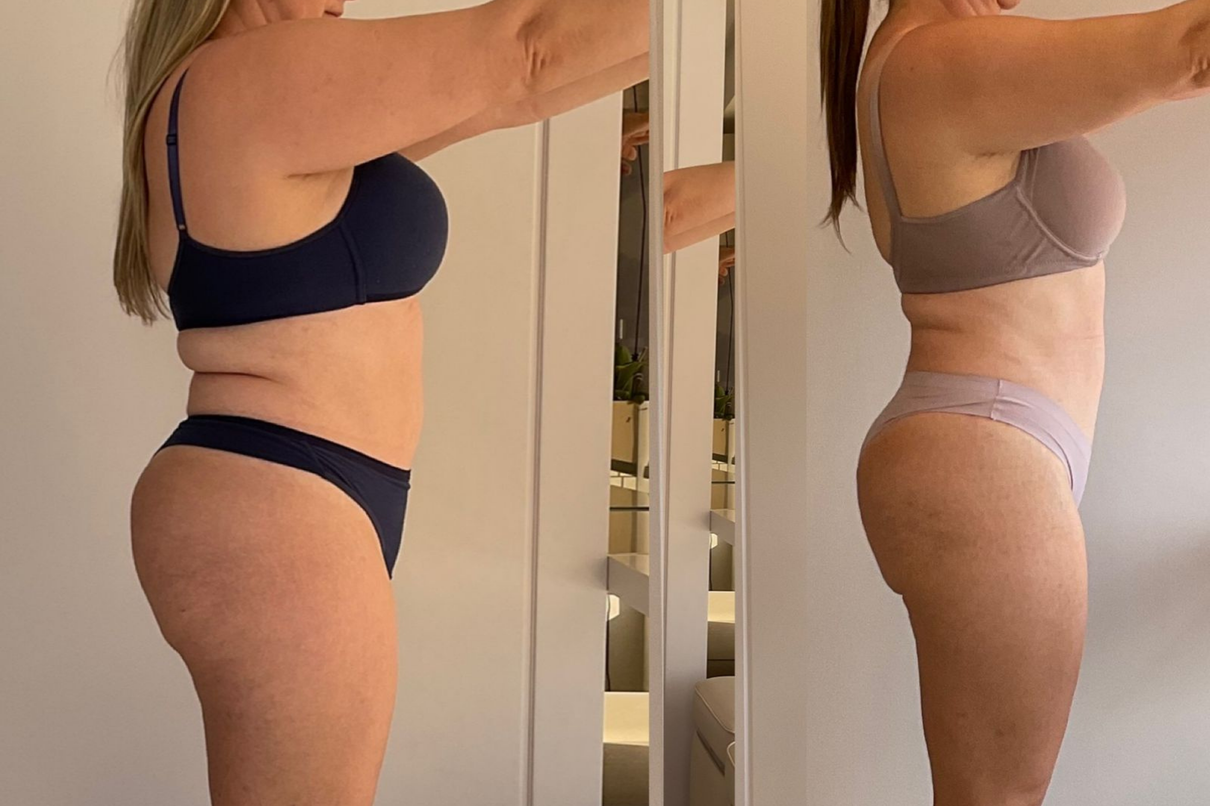 Antes e depois · Emagrecimento · Vivency