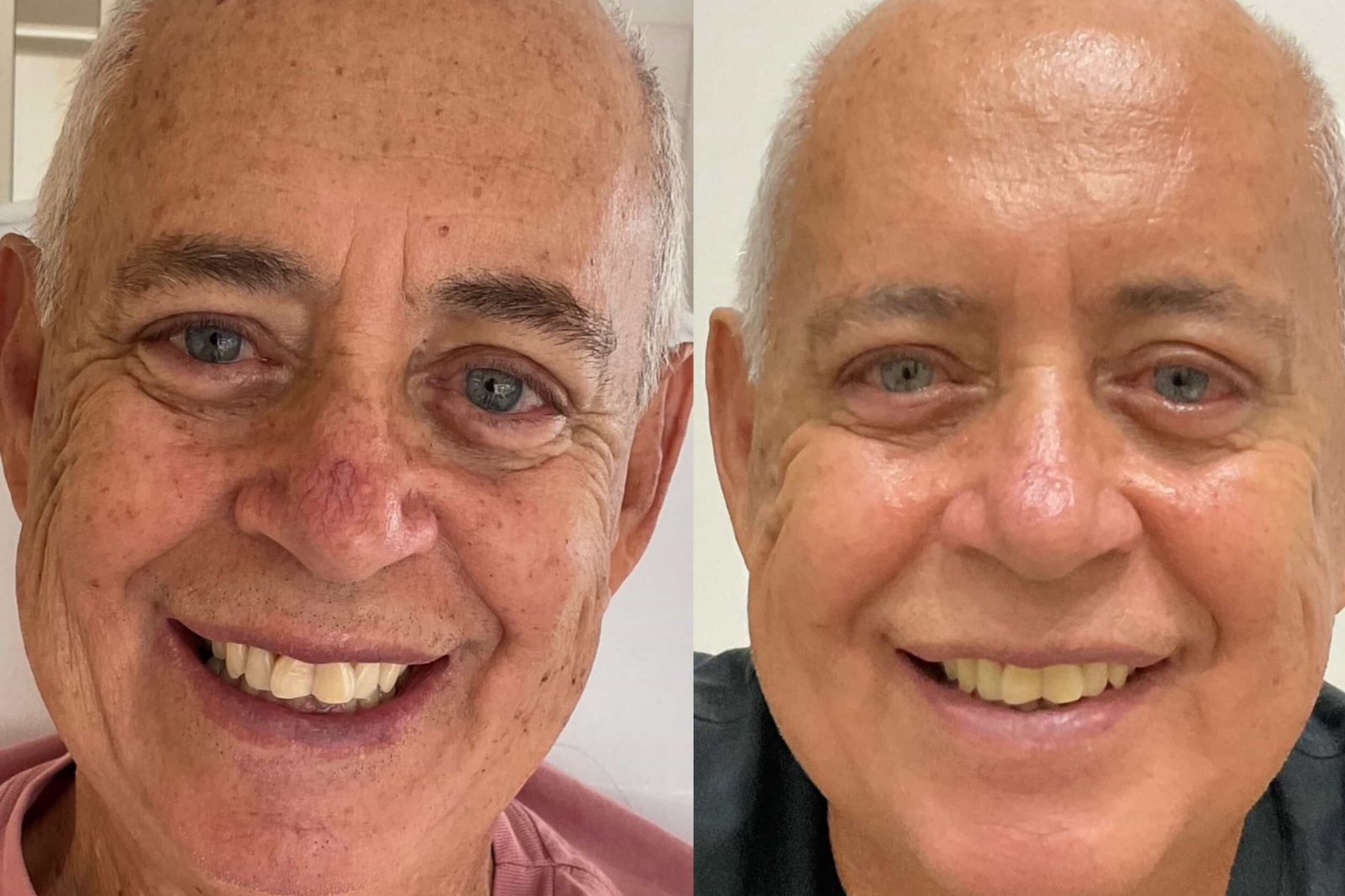 Antes e depois · Facial · Vivency