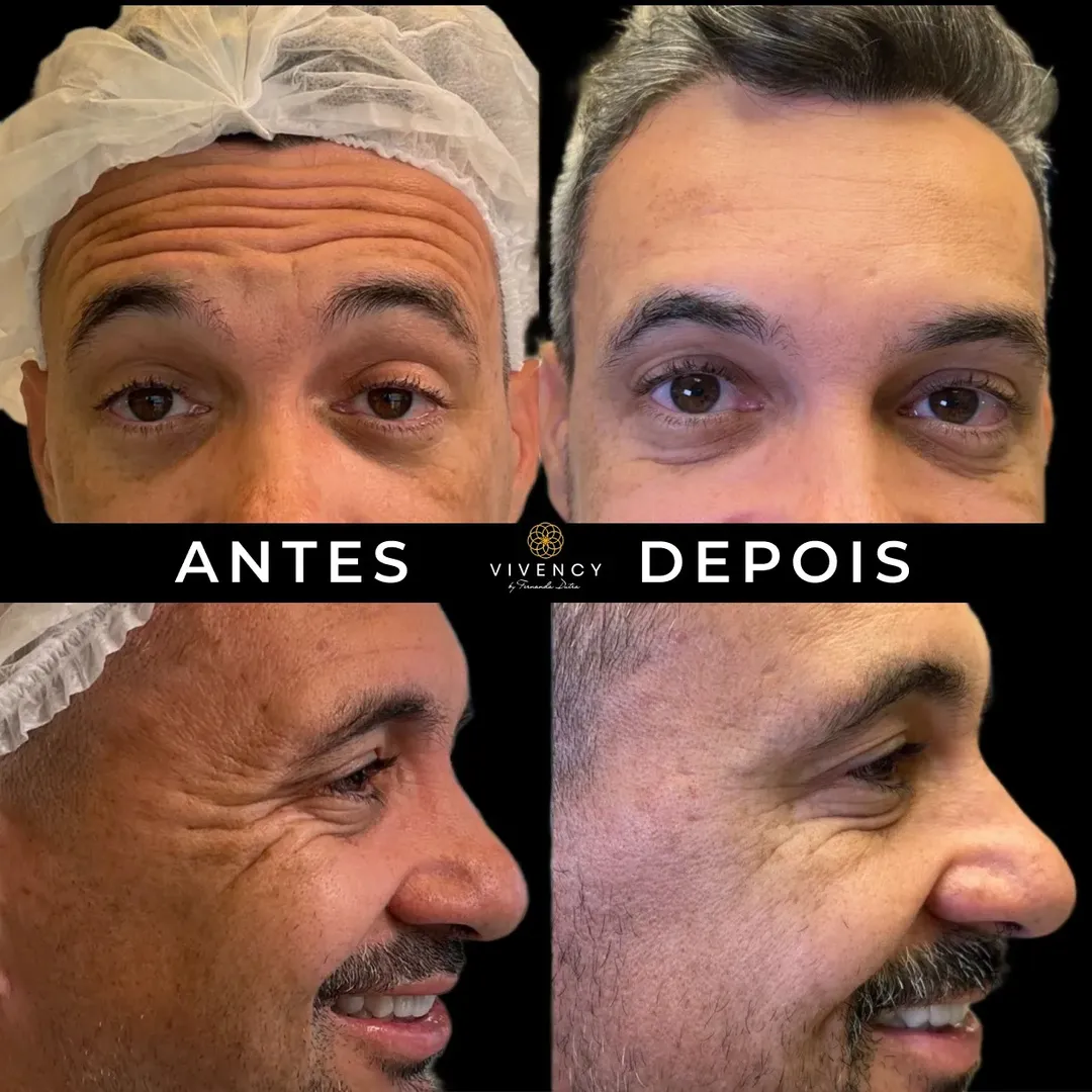 Antes e depois · Vivency