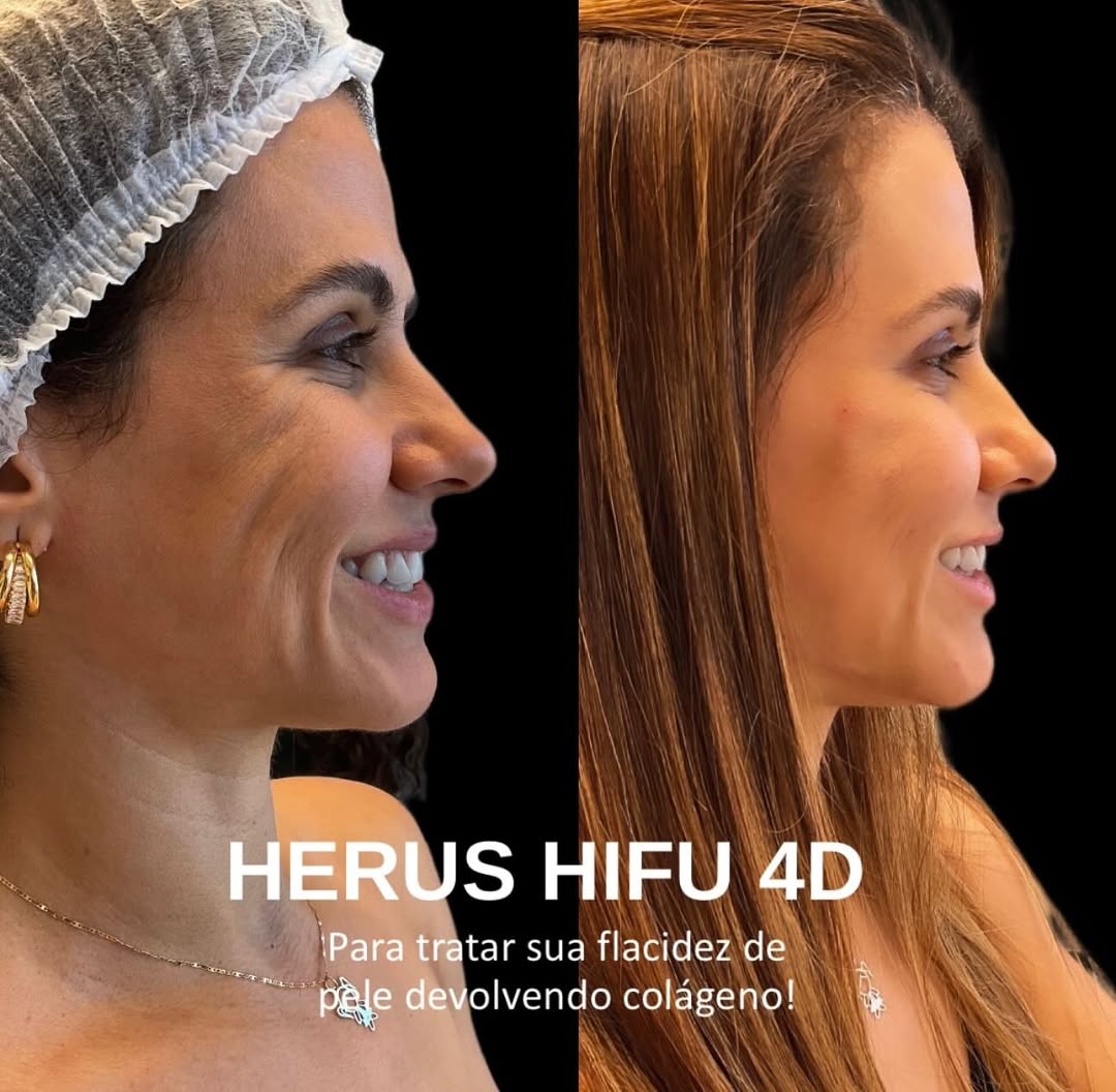 Antes e depois · Vivency